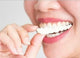 Temporary Teeth Braces Cover